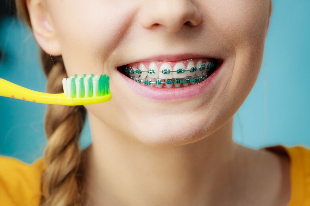aparat-ortodontyczny-higiena-jamy-ustnej