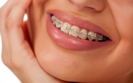 jak długo trwa leczenie ortodontyczne?