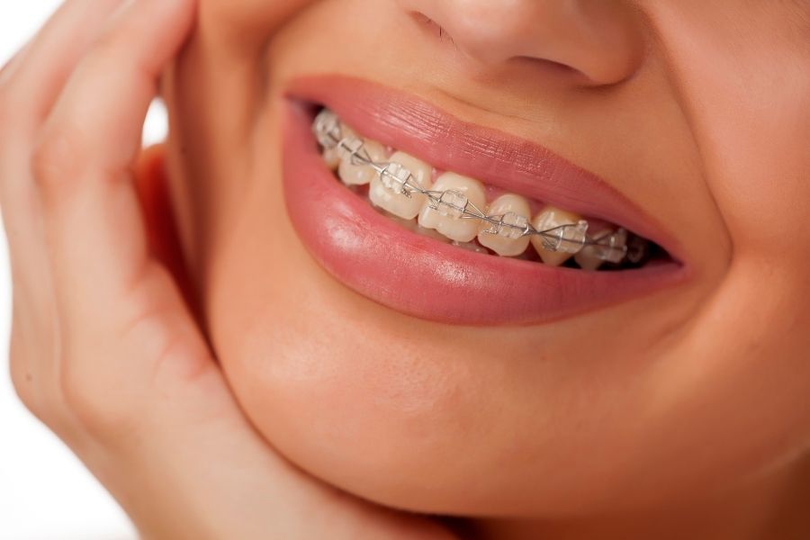 jak długo trwa leczenie ortodontyczne?